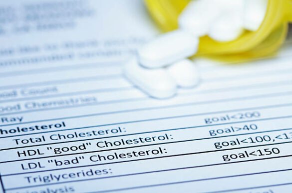 What causes low HDL and How to Boost Good Cholesterol?